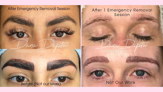 What Is Emergency Li-FT® Removal — And Why Every PMU Artist Should Know About It