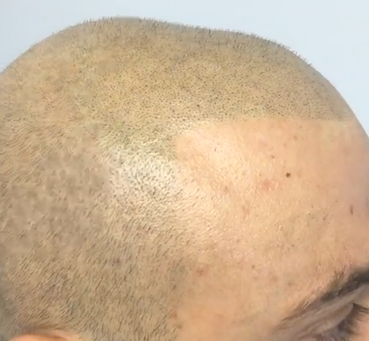 darkest-brown-scalp-pigment-with-pumpkin-drop-taryn-quinterri