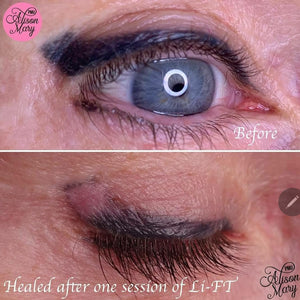 Li-FT PMU saline removal products trusted by professional permanent makeup artists worldwide