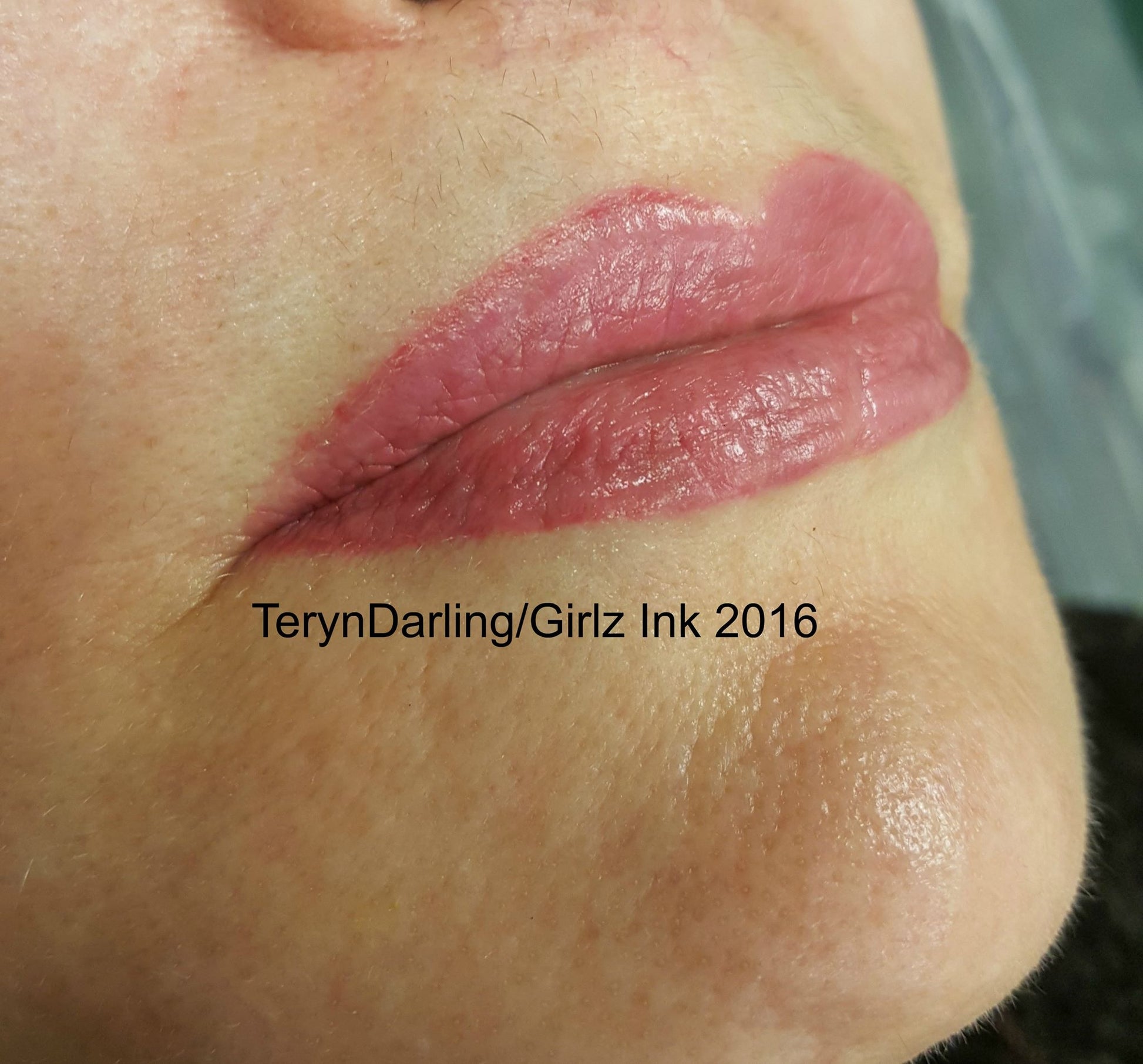Healed lips showing a 50/50 blend of Berry Persistent and Pink Coral Pop by Teryn Darling.