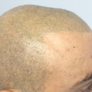 darkest-brown-scalp-pigment-with-pumpkin-drop-taryn-quinterri