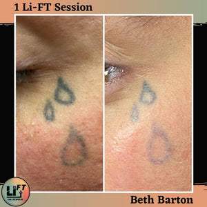 Li-FT professional PMU removal products formulated for saline-based tattoo and permanent makeup correction