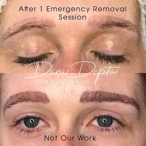 Before and after emergency PMU saline removal session using Li-FT pigment lightening solution by Dana Depta.