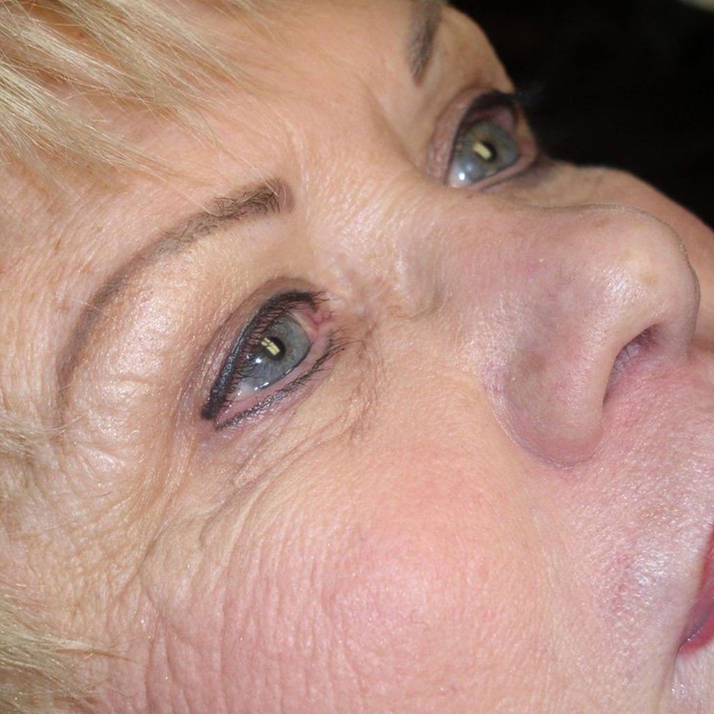 Healed results using Aqua Eyeliner and Ebony Brown pigment by Sarah Woodcock