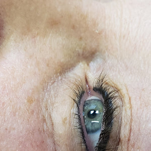 Healed permanent eyeliner ten years after application using Li Pigments Ultra Black pigment, showing excellent color retention and definition along the lash line.