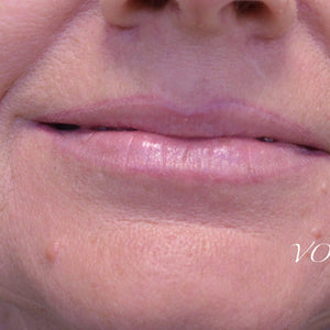 Healed lip neutralization result using Aqua Pink and 3 drops of Neon Orange Mod by Caroline De Jonge.
