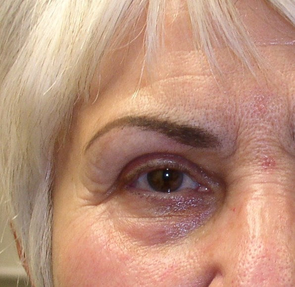 Healed brow color correction using Taupe and Charcoal pigment blend for a natural, cool-toned finish.